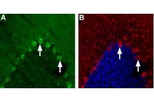 Expression of nAChR α4 in rat cerebellumImmunohistochemical staining of immersion-fixed, free floating rat brain frozen sections using Anti-Nicotinic Acetylcholine Receptor α4 (CHRNA4) (extracellular) Antibody (ABIN7581854), (1:200).