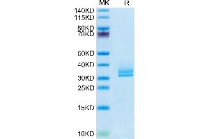 ANGPTL2 Protein (AA 260-493) (His-Avi Tag,Biotin)