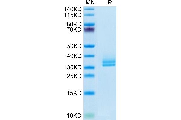 ANGPTL2 Protein (AA 260-493) (His-Avi Tag,Biotin)