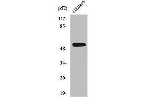 Western Blot analysis of COLO205 cells using XPLN Polyclonal Antibody (ARHGEF3 antibody  (C-Term))