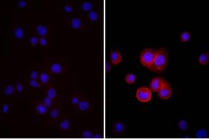 Human pancreatic carcinoma cell line MIA PaCa-2 was stained with Mouse Anti-Human CD44-UNLB, and DAPI. (Donkey anti-Mouse IgG (Heavy & Light Chain) Antibody (FITC) - Preadsorbed)