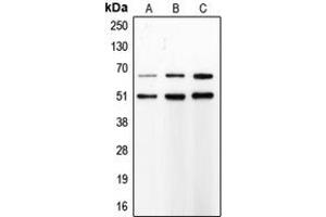 Western blot analysis of MMP8 expression in SJRH30 (A), PMNL (B), Sw620 (C) whole cell lysates. (MMP8 antibody  (C-Term))