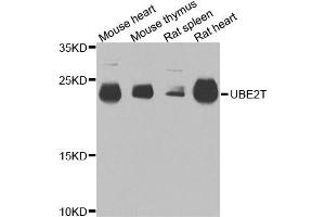 Western blot analysis of extracts of various cells, using UBE2T antibody. (Ube2t antibody)