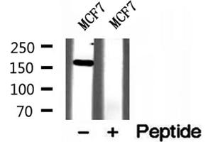Western blot analysis of extracts of MCF7 cells, using ZCCHC11 antibody.