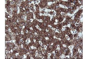 Immunohistochemistry (IHC) image for anti-Acetyl-CoA Acyltransferase 2 (ACAA2) antibody (ABIN1495727) (ACAA2 antibody)