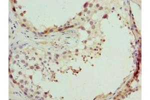 Immunohistochemistry of paraffin-embedded human testis tissue using ABIN7148653 at dilution of 1:100 (CPXCR1 antibody  (AA 1-301))