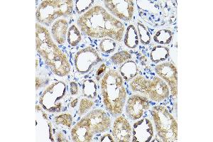 Immunohistochemistry of paraffin-embedded rat kidney using CC2D1A Rabbit pAb (ABIN1679010, ABIN3019218, ABIN3019219 and ABIN6220767) at dilution of 1:200 (40x lens).