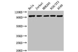 Western Blot Positive WB detected in: Hela whole cell lysate, Jurkat whole cell lysate, HEK293 whole cell lysate, NIH/3T3 whole cell lysate, A549 whole cell lysate All lanes: DDR2 antibody at 3. (DDR2 antibody  (AA 447-540))