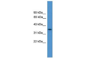 WB Suggested Anti-C4orf19 Antibody Titration:  0. (C4orf19 antibody  (N-Term))