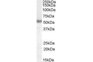 Western Blotting (WB) image for Neuro-Oncological Ventral Antigen 1 (NOVA1) peptide (ABIN369762)