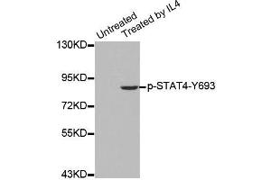 Western blot analysis of extracts from HepG2 cells using Phospho-STAT4-Y693 antibody (ABIN2987407). (STAT4 antibody  (pTyr693))