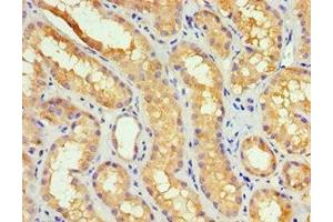Immunohistochemistry of paraffin-embedded human kidney tissue using ABIN7149383 at dilution of 1:100 (GBA3 antibody  (AA 1-162))