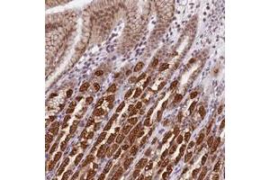 Immunohistochemical staining of human stomach with TMEM104 polyclonal antibody  shows strong cytoplasmic and nuclear positivity in glandular cells at 1:200-1:500 dilution. (TMEM104 antibody)