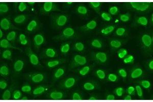 Immunofluorescence analysis of HeLa cells using FEN1 Polyclonal Antibody (FEN1 antibody)