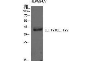 Western Blot (WB) analysis of HepG2-UV cells using Lefty Polyclonal Antibody. (LEFTY1 antibody  (Internal Region))