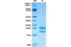 Biotinylated Human VEGF121 on Tris-Bis PAGE under reduced condition. (VEGF121 Protein (His-Avi Tag,Biotin))
