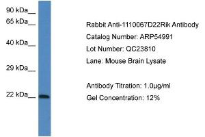 Western Blotting (WB) image for anti-Galectin-Related Protein (GRP) (Middle Region) antibody (ABIN2774094) (GRP antibody  (Middle Region))