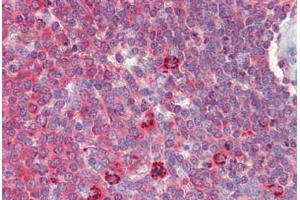 Spleen, Human: Formalin-Fixed, Paraffin-Embedded (FFPE) (HSPD1 antibody)