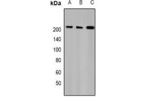 Western blot analysis of TAF172 expression in Hela (A), MCF7 (B), rat testis (C) whole cell lysates.