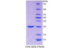 SDS-PAGE (SDS) image for Annexin A2 (ANXA2) (AA 1-339) protein (His tag) (ABIN1169886) (Annexin A2 Protein (ANXA2) (AA 1-339) (His tag))