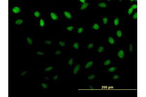 Immunofluorescence of purified MaxPab antibody to ZNF643 on HeLa cell. (ZNF643 antibody  (AA 1-432))