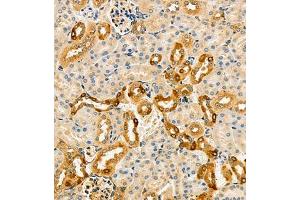 Immunohistochemistry of paraffin embedded mouse kidney using ARSK (ABIN7073123) at dilution of 1:2000 (300x lens) (Arylsulfatase K antibody)
