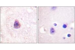 Immunohistochemistry (IHC) image for anti-Arrestin, beta 1 (ARRB1) (AA 369-418) antibody (ABIN2888645) (beta Arrestin 1 antibody  (AA 369-418))
