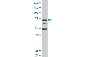 DCST1 polyclonal antibody (A01), Lot # 060111JC01. (DCST1 antibody  (AA 532-630))