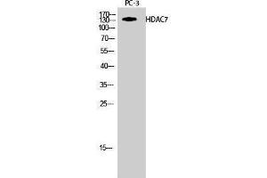 Western Blotting (WB) image for anti-Histone Deacetylase 7 (HDAC7) (Tyr721) antibody (ABIN3184990)