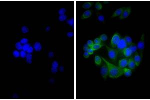 Human pancreatic carcinoma cell line MIA PaCa-2 was stained with Mouse Anti-Cytokeratin 18-UNLB, and DAPI. (Goat anti-Mouse Ig (Chain kappa) Antibody (Biotin))