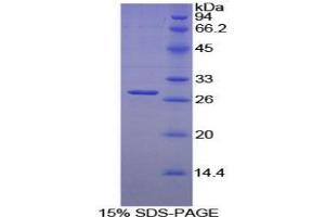 SDS-PAGE analysis of Mouse LILRB3 Protein. (LILRB3 Protein)