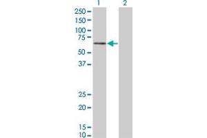 Western Blot analysis of PKNOX1 expression in transfected 293T cell line by PKNOX1 monoclonal antibody (M07), clone 2A12. (PKNOX1 antibody  (AA 2-100))