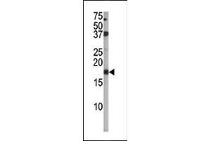 The anti-Phospho-p16-INK4A- Pab (ABIN6241061 and ABIN6578926) is used in Western blot to detect Phospho-p16-INK4A- in  tissue lysate (CDKN2A antibody  (pSer140))