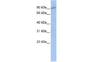 WB Suggested Anti-SLC15A2  Antibody Titration: 0. (SLC15A2 antibody  (Middle Region))