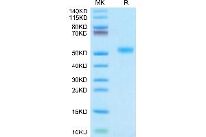 IL11RA Protein (AA 24-370) (His tag)