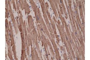 Immunohistochemical staining (Formalin-fixed paraffin-embedded sections) of human heart with ACTC1 monoclonal antibody, clone RM257  at a 1:1000 dilution. (ACTC1 antibody  (N-Term))