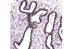IHC analysis of PARN using anti-PARN antibody . (PARN antibody  (AA 1-301))