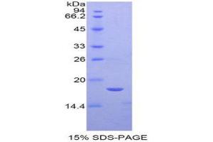 SDS-PAGE (SDS) image for Sema Domain, Immunoglobulin Domain (Ig), Short Basic Domain, Secreted, (Semaphorin) 3A (SEMA3A) (AA 31-150) protein (His tag) (ABIN1877372) (SEMA3A Protein (AA 31-150) (His tag))