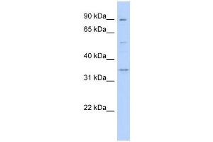 WNT9B antibody used at 1 ug/ml to detect target protein. (WNT9B antibody  (Middle Region))