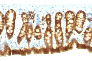 Formalin-fixed, paraffin-embedded Rat Colon stained with Ep-CAM Monoclonal Antibody (Epcam/1158). (EpCAM antibody)