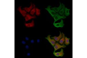 ABIN6257903 and ABIN6275344 staining Hela cells by IF/ICC.