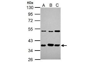 Western Blotting (WB) image for anti-Aryl Hydrocarbon Receptor Interacting Protein (AIP) antibody (ABIN2856771)