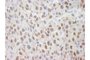 Immunohistochemistry (IHC) image for anti-Cullin 4A (CUL4A) (C-Term) antibody (ABIN7448505)
