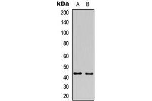 Western blot analysis of GAP43 expression in HeLa (A), mouse brain (B) whole cell lysates.