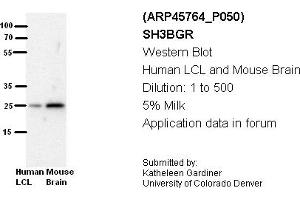 Image no. 2 for anti-SH3 Domain Binding Glutamic Acid-Rich Protein (SH3BGR) (N-Term) antibody (ABIN310728) (SH3BGR antibody  (N-Term))