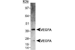 Image no. 2 for anti-Vascular Endothelial Growth Factor A (VEGFA) (AA 150-250), (Internal Region) antibody (ABIN363519) (VEGFA antibody  (Internal Region))