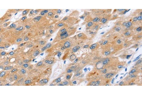 ERVW-1 antibody