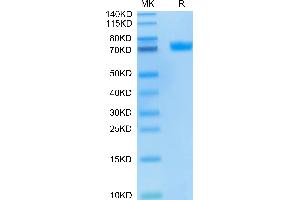 SDS-PAGE (SDS) image for Mesothelin (MSLN) (AA 296-580) protein (FITC,Fc Tag) (ABIN7275284)