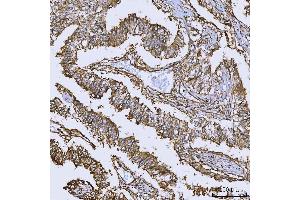IHC analysis of Annexin A10/ANXA10 using anti-Annexin A10/ANXA10 antibody (ABIN7601853).