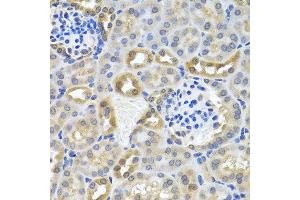 Immunohistochemistry of paraffin-embedded mouse kidney using DEDD antibody at dilution of 1:100 (40x lens).